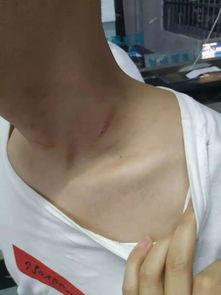 温州网友打架爆料视频曝光